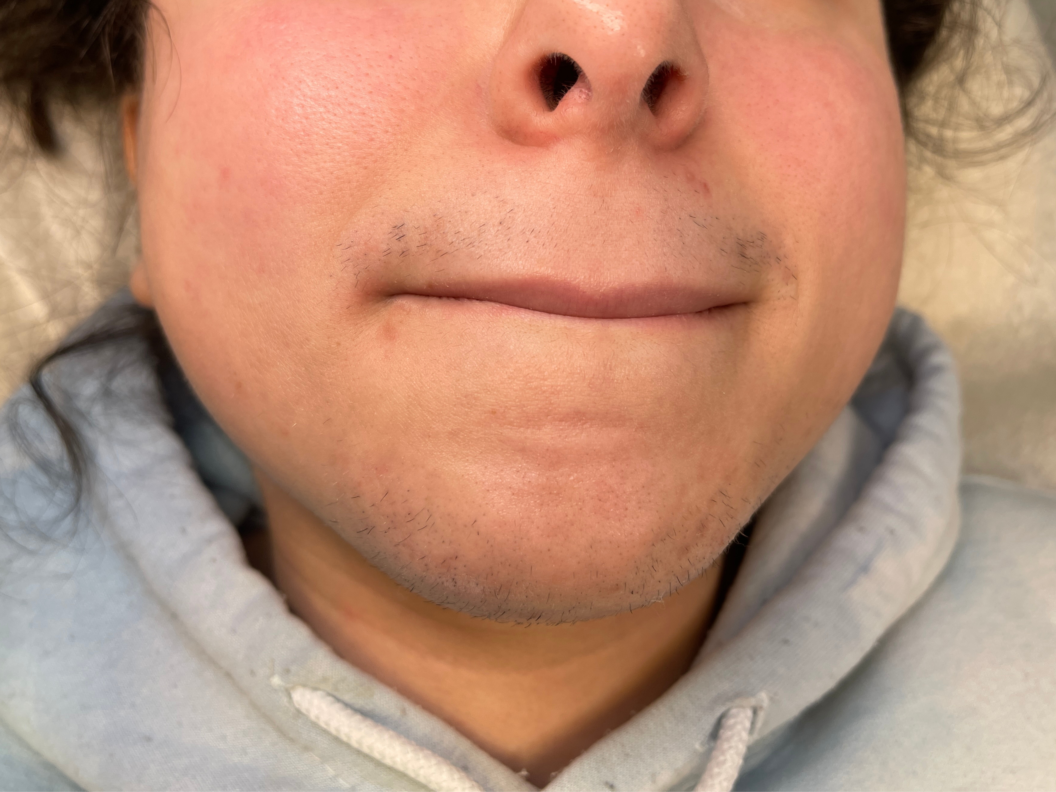 Before