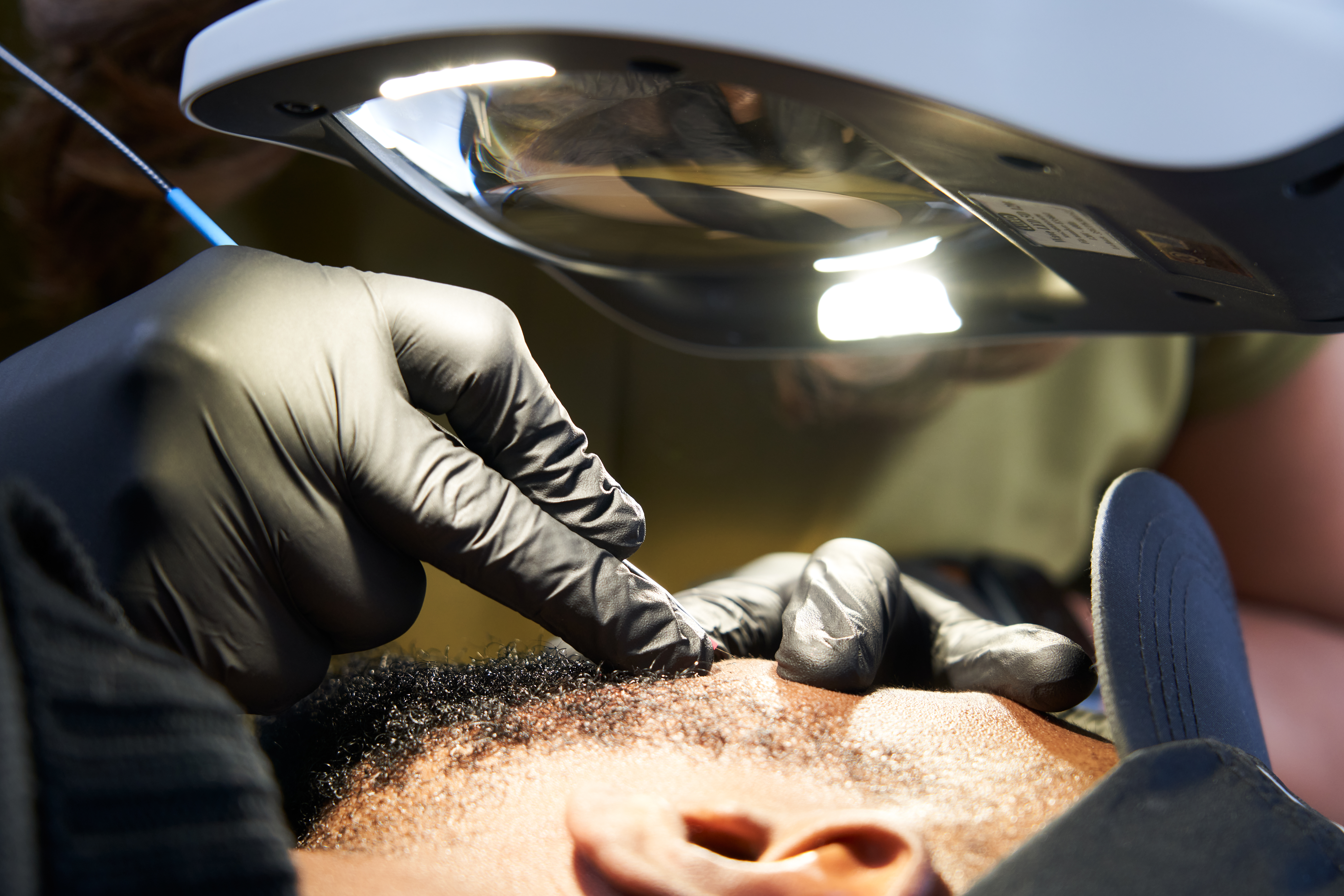 Electrolysis Image